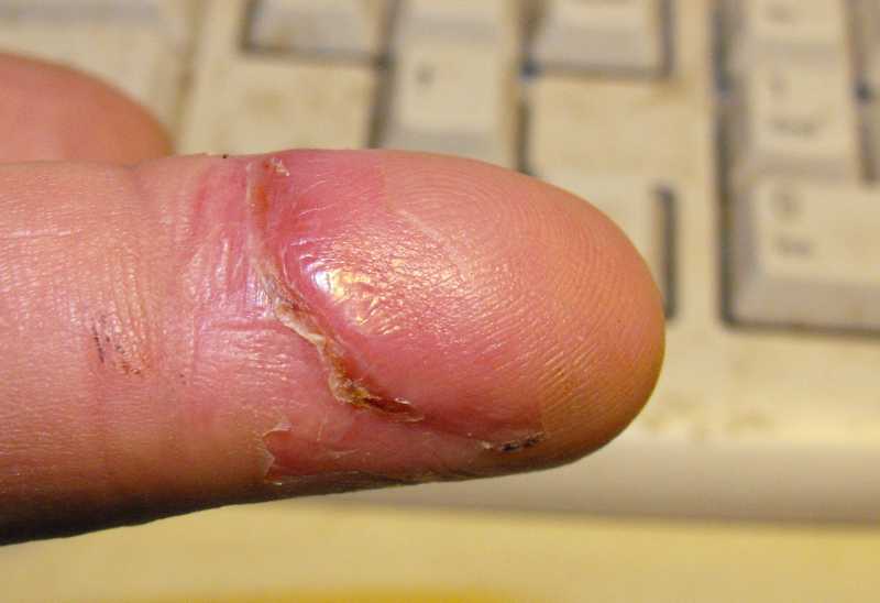 finger30.jpg